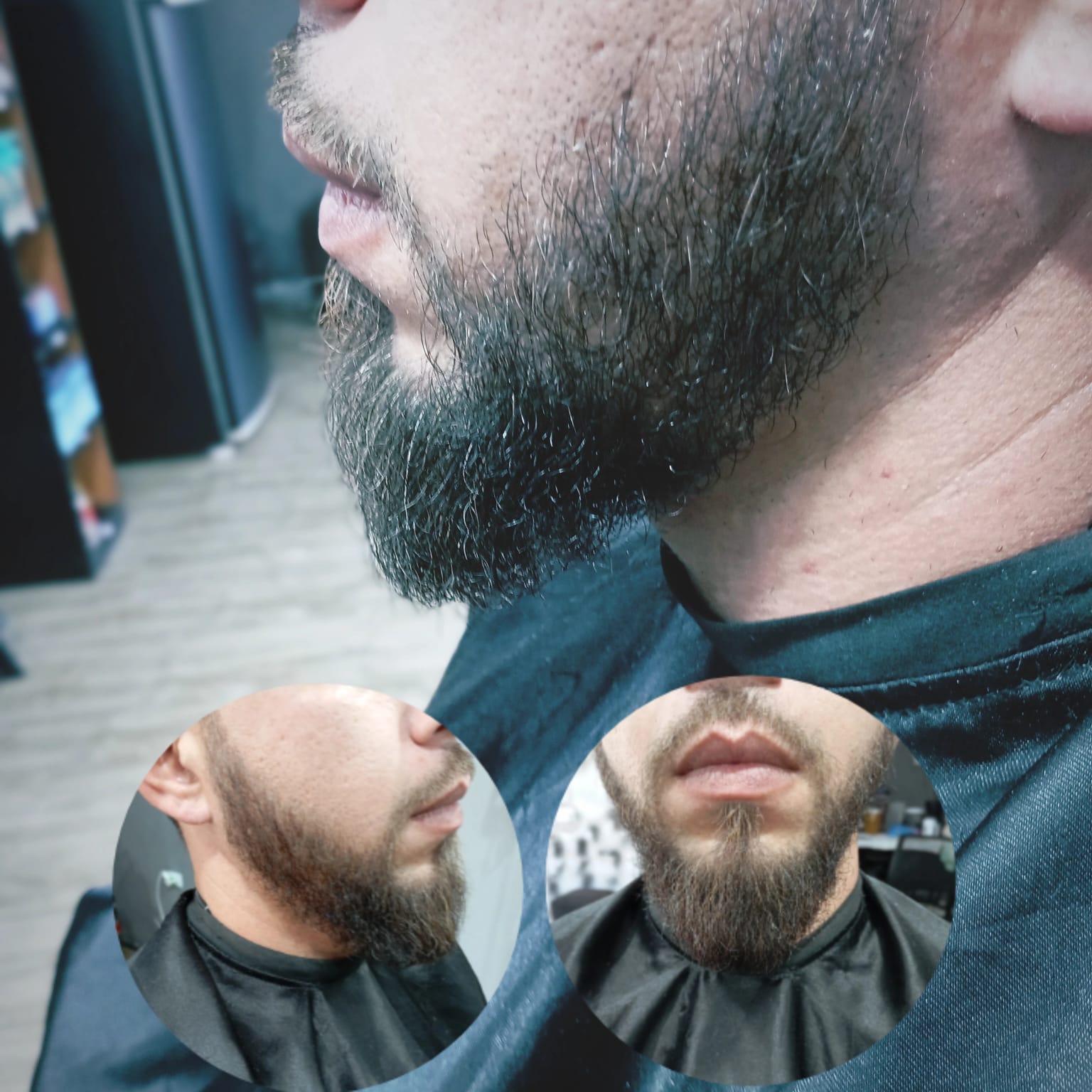 Antes e Depois 2